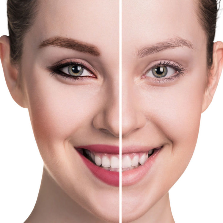 54248252 – comparative portrait of female face, without and with makeup